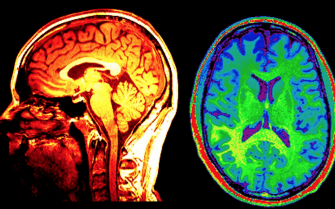 Medical Marijuana, Inc. and Kannalife Sciences, Inc. Announce Joint Effort to Raise Awareness for CTE Research